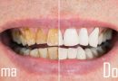 Otterrai denti più bianchi e lucenti con questo rimedio casalingo: basta dentista!